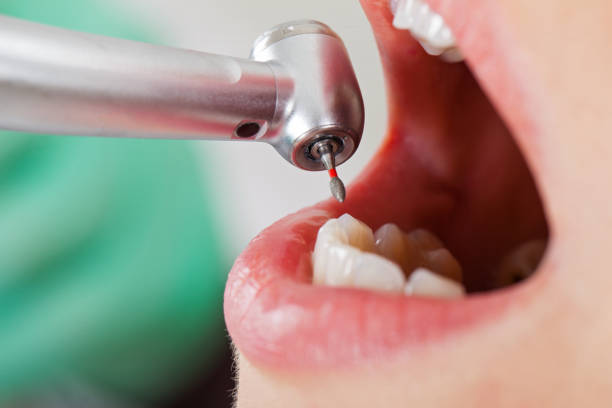 Best Cosmetic Emergency Dentistry in Alto, TX